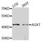 Alanine--Glyoxylate And Serine--Pyruvate Aminotransferase antibody, A8397, ABclonal Technology, Western Blot image 