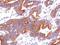 Family With Sequence Similarity 234 Member A antibody, GTX119235, GeneTex, Immunohistochemistry paraffin image 