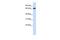 DDB1 And CUL4 Associated Factor 4 antibody, GTX45304, GeneTex, Western Blot image 