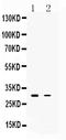 TNF Alpha Induced Protein 6 antibody, A03433-1, Boster Biological Technology, Western Blot image 