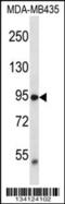 Transient Receptor Potential Cation Channel Subfamily V Member 2 antibody, 57-444, ProSci, Western Blot image 