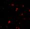 G Protein-Coupled Receptor Kinase 6 antibody, A03623-1, Boster Biological Technology, Immunofluorescence image 