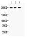 Receptor-type tyrosine-protein phosphatase F antibody, PA5-79898, Invitrogen Antibodies, Western Blot image 