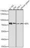 Bruton Tyrosine Kinase antibody, 13-186, ProSci, Western Blot image 