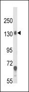 Calcium Voltage-Gated Channel Auxiliary Subunit Alpha2delta 1 antibody, 63-598, ProSci, Western Blot image 