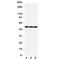 Arrestin Beta 1 antibody, R31275, NSJ Bioreagents, Western Blot image 