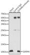 S100 Calcium Binding Protein A6 antibody, GTX64584, GeneTex, Immunoprecipitation image 
