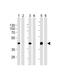 Metalloreductase STEAP2 antibody, A08410-2, Boster Biological Technology, Western Blot image 