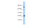 TNF Superfamily Member 12 antibody, 25-364, ProSci, Western Blot image 