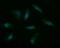Musashi RNA Binding Protein 2 antibody, LS-C174732, Lifespan Biosciences, Immunofluorescence image 