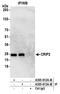Cysteine Rich Protein 2 antibody, A305-612A-M, Bethyl Labs, Immunoprecipitation image 
