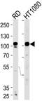 ATPase Sarcoplasmic/Endoplasmic Reticulum Ca2+ Transporting 1 antibody, MBS9211503, MyBioSource, Western Blot image 