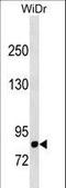 Dipeptidyl Peptidase 4 antibody, LS-C157693, Lifespan Biosciences, Western Blot image 