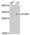 Potassium Voltage-Gated Channel Subfamily E Regulatory Subunit 4 antibody, LS-C747353, Lifespan Biosciences, Western Blot image 