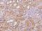 LIM And Cysteine Rich Domains 1 antibody, 200550-T08, Sino Biological, Immunohistochemistry paraffin image 
