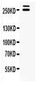 WNK1 antibody, PA5-80229, Invitrogen Antibodies, Western Blot image 