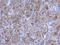 Transglutaminase 2 antibody, NBP2-20698, Novus Biologicals, Immunohistochemistry frozen image 