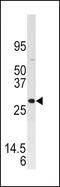 Dual Specificity Phosphatase 3 antibody, PA5-15609, Invitrogen Antibodies, Western Blot image 