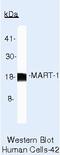 Melan-A antibody, MA5-14168, Invitrogen Antibodies, Western Blot image 