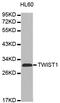 Twist Family BHLH Transcription Factor 1 antibody, TA332745, Origene, Western Blot image 