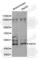 Sirtuin 6 antibody, A1258, ABclonal Technology, Western Blot image 