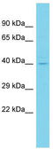 Coiled-Coil Domain Containing 81 antibody, TA330710, Origene, Western Blot image 