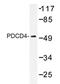 Programmed Cell Death 4 antibody, AP20338PU-N, Origene, Western Blot image 