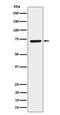 CTP Synthase 1 antibody, M06374, Boster Biological Technology, Western Blot image 