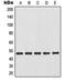 NFKB Inhibitor Beta antibody, orb214315, Biorbyt, Western Blot image 