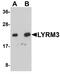 NADH:Ubiquinone Oxidoreductase Subunit B9 antibody, A08623-1, Boster Biological Technology, Western Blot image 