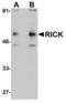 Receptor Interacting Serine/Threonine Kinase 2 antibody, LS-B1394, Lifespan Biosciences, Western Blot image 