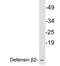 Defensin Beta 4B antibody, LS-C199829, Lifespan Biosciences, Western Blot image 