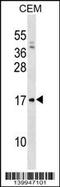 V-Set Pre-B Cell Surrogate Light Chain 1 antibody, 60-450, ProSci, Western Blot image 