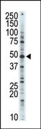 Cyclin Dependent Kinase 10 antibody, AP14137PU-N, Origene, Western Blot image 