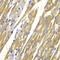 Tyrosinase antibody, GTX16389, GeneTex, Immunohistochemistry paraffin image 