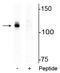 Androgen Receptor antibody, P00542-1, Boster Biological Technology, Western Blot image 