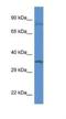 General Transcription Factor IIB antibody, NBP1-91492, Novus Biologicals, Western Blot image 