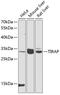 TIR Domain Containing Adaptor Protein antibody, GTX65910, GeneTex, Western Blot image 