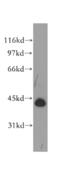 TAR DNA Binding Protein antibody, GTX30809, GeneTex, Western Blot image 