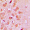 ST6 Beta-Galactoside Alpha-2,6-Sialyltransferase 1 antibody, LS-C352845, Lifespan Biosciences, Immunohistochemistry frozen image 
