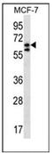 Pogo Transposable Element Derived With KRAB Domain antibody, AP53377PU-N, Origene, Western Blot image 