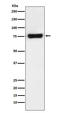 Metastasis Associated 1 Family Member 2 antibody, M03073, Boster Biological Technology, Western Blot image 