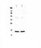 Fatty Acid Binding Protein 3 antibody, PA1336, Boster Biological Technology, Western Blot image 