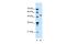 Solute Carrier Family 37 Member 3 antibody, PA5-42500, Invitrogen Antibodies, Western Blot image 