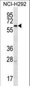 Membrane Bound Transcription Factor Peptidase, Site 2 antibody, LS-C164068, Lifespan Biosciences, Western Blot image 