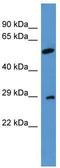 Calcium Binding Protein 4 antibody, TA342744, Origene, Western Blot image 