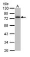 Calpain 3 antibody, NBP1-31756, Novus Biologicals, Western Blot image 