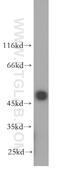 Ubiquitin Specific Peptidase 34 antibody, 18827-1-AP, Proteintech Group, Western Blot image 