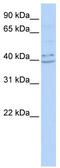 Pyrin And HIN Domain Family Member 1 antibody, TA339837, Origene, Western Blot image 