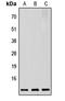 PTMA antibody, LS-C358258, Lifespan Biosciences, Western Blot image 